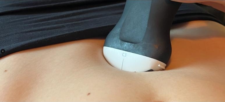 Bloom condition monitoring illustration