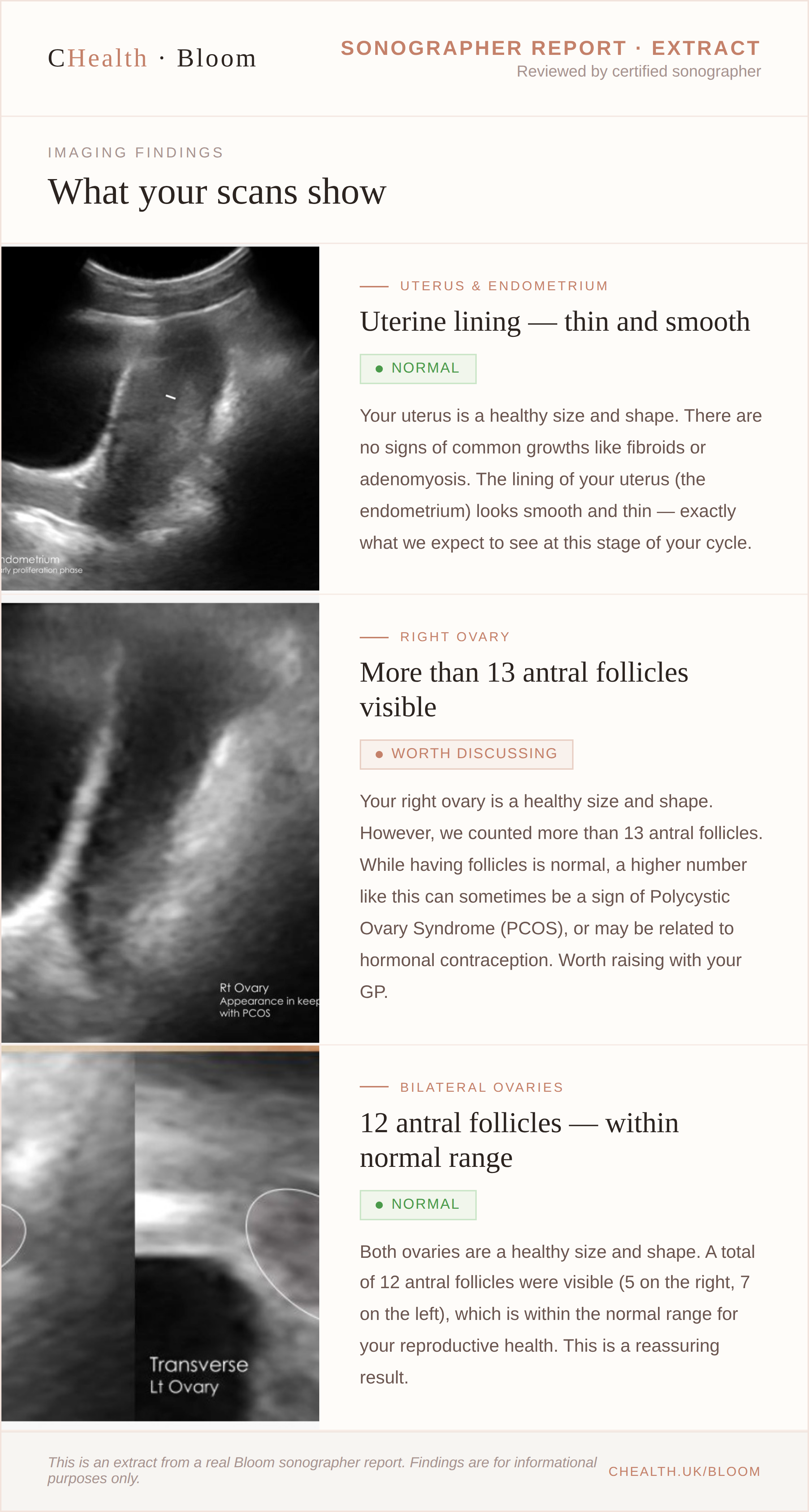 Sample Bloom report extract showing clinical findings